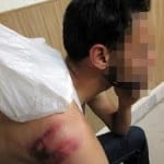 Tortured_Raped