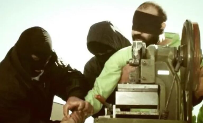 Iran Must Be Held Accountable For Prisoner Amputations – Rights Group